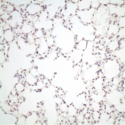 小鼠肺組織感染無PB2適應性變異的禽流感病毒。